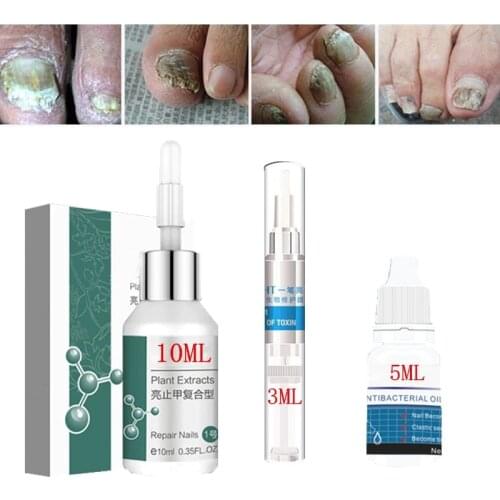3/5/10ML Nail Fungus Repair Treatment Product Remedy Nail Fungus Onychomycosis Paronychia Anti Fungal Infection Chinese Herbal