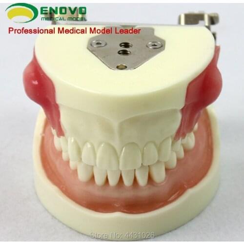 ENOVO Oral practice examination abscess incision and tooth preparation model alveolar abscess incision drainage