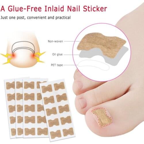 1/5Pcs Nail Strips Anti-roll Nail Free Glue Toe Inlay Nail Corrector Nail Patch Correction Stickers Nail Care Foot Care