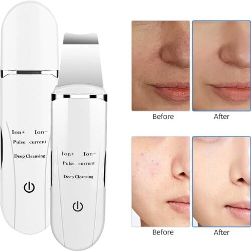 Ultrasonic Facial Deep Cleaning Skin Scrubber Peeling Shovel Face Pore Cleaner Blackhead Removal Lifting Beauty Salon Equipment