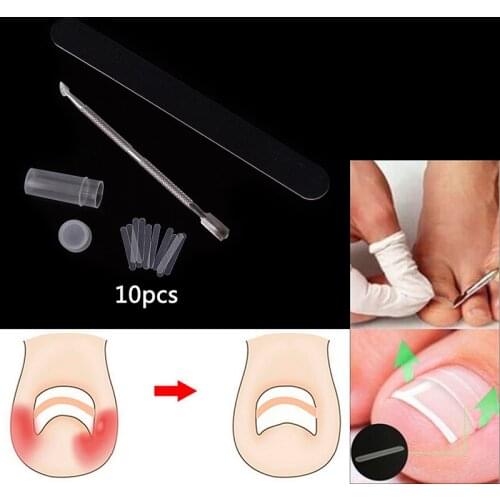 1 Set Ingrown Toenail Correction Kit Toenail Treatment Nail File Toenail Straightening Patch Pusher Recover Foot Care