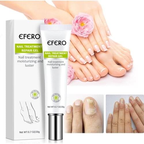 15ml Infection Beauty Nail Fungal Treatment Gel Health Instant Be Nail Fungal Infection Treatment Cream Nail Repair Gel