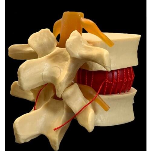 Human anatomy skeleton Spine Lumbar Disc Herniation Teaching Model brain skull traumatic pistol school supplies medical instrume