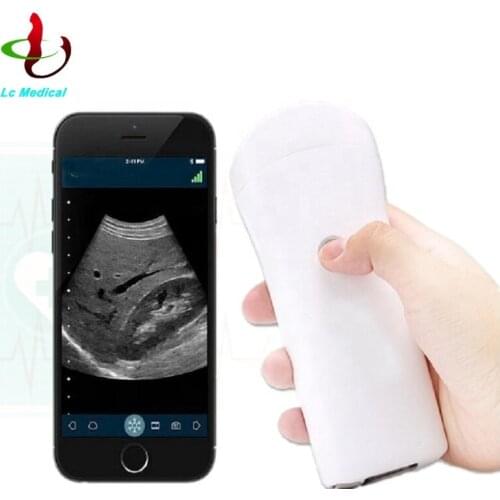 Ultrasound Wireless Scanner Micro Convex Probe/Sonoscape Wireless Micro Convex Ultrasound Scanner with In Stock