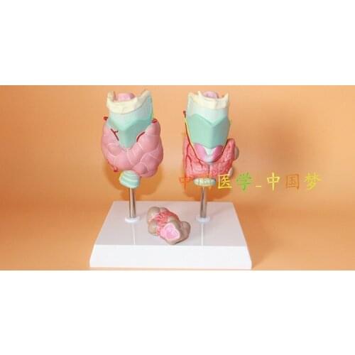 Thyroid Pathological Dissection model Thyroid tumors model Medical Teaching 16.5*13*20cm free shipping