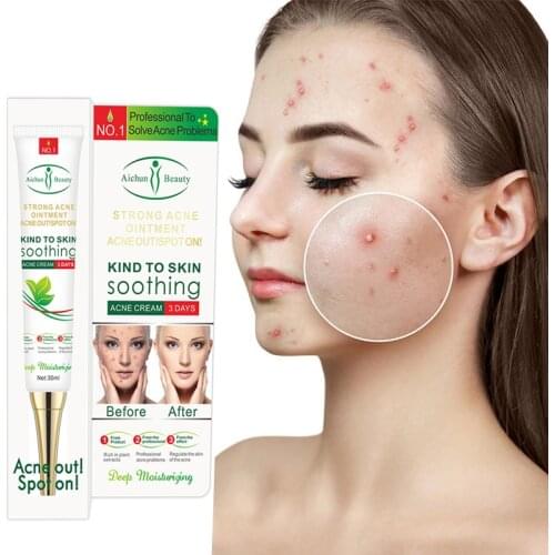 Effective Acne Removal Cream Acne Treatment Fade Acne Spots Oil Control Shrink Pores Whitening Moisturizing Acne Cream Skin Care