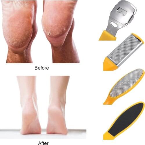 20 PCS Pedicure Set Foot Sharpener Set Nail File Foot Rubbing Scraper Peeling Pedicure Knife Tools Toe Rest Polishing Strip Kits