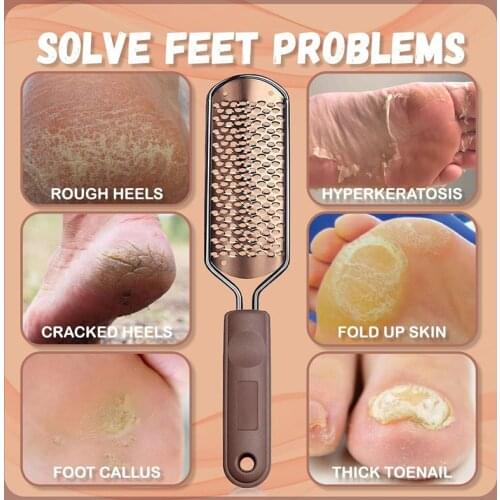 Foot Heel Scraper Stainless Steel Foot File Callus Dead Skin Remover Washable Pedicure Tool for Home can CSV
