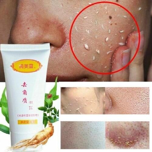 Exfoliating Gel Scrubs Peeling Dead Skin Removal Body And For Face Care Cleanser Gel Skin Exfoliating Peeling S3K8