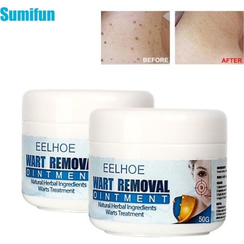 30/50g Warts Ointment Skin Tag Remover Remove Mole Wart Antibacterial Cream Warts Treatment Herbal Extract Plaster Skin Care