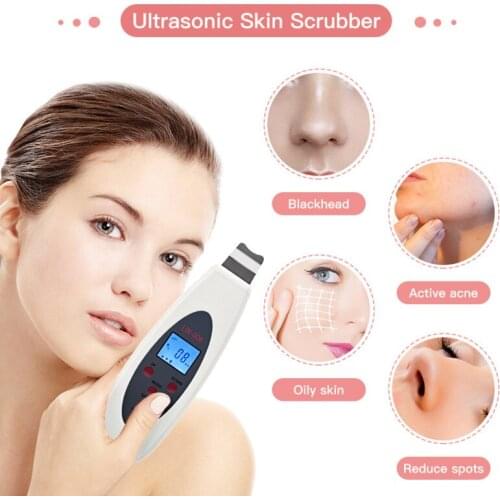 High frequency vibration Ultrasonic peeling machine Exfoliating blackheads Pore deep cleansing instrument