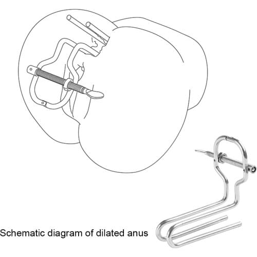 Gumgum Anal Dilator