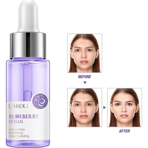 17ml Natural Blueberry Serum Essence Moisturizing Anti Wrinkle Anti Aging Shrink Pores Oil Control Improves Dull Skin Face Care