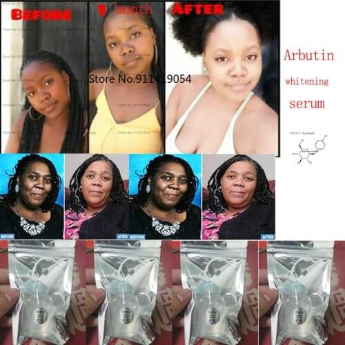 Whitening Serum Natural Alpha Arbutin Skin Care Permanent Bleaching Serums Dark Lightening Cream Kojic Acid Brightening 30ml