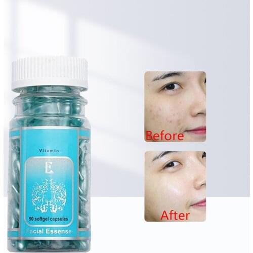 90Pcs Aloe Vera Vitamin E Serum Face Care Capsule Cream Repair Ance Scar Anti Aging Moisturizing Whitening Brightening Skin Care