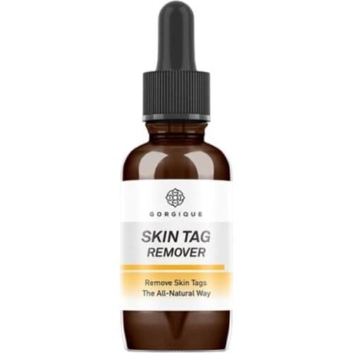 Effective Whitening Freckle Cream Remove Melasma Acne Spot Pigment Melanin Dark Spots Pigmentation Moisturizing Gel Skin Care