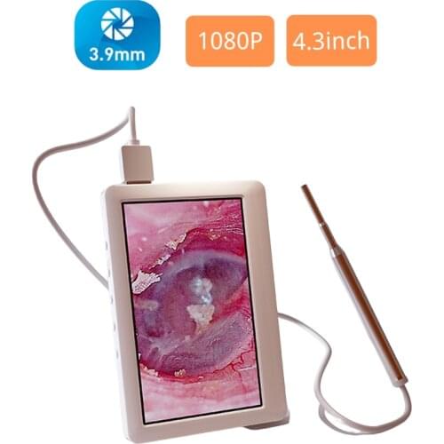 3.9mm Digital Otoscope Ear Camera with 4.5 Inch Screen 6 Adjustable LED Lights Ear Wax Removal Tool Rechargeable Battery
