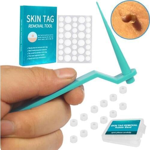 Skin Tag Remover Removal Meat Mole Removal Corn And Wart Skin Rubber Ring Skin Tag Micro Skin With Cleansing Swab Skin Care Tool