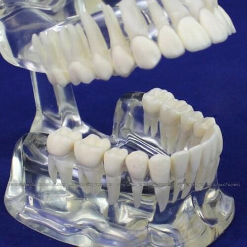 CMAM/12571 Dental- Transparent jaw, Human Oral Dental Medical Teaching Anatomical Model