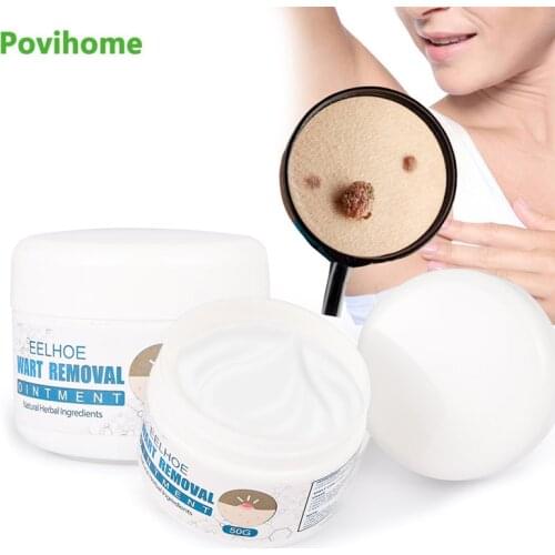 1Pcs 50g Wart Removal Cream Skin Tag Body Mole Corn Sarcoma Remover Herbal Antibacterial Warts Ointment Health Care Plaster