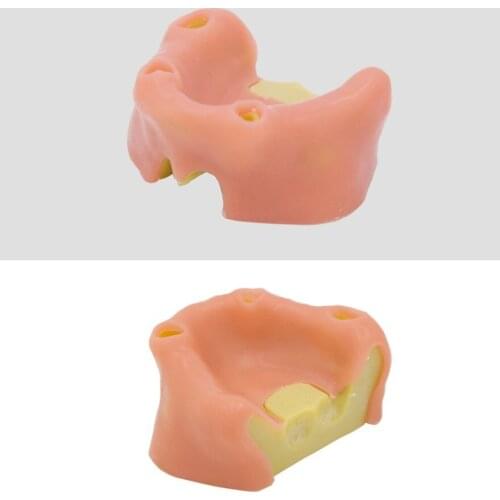 Dental material Oral implant practice Soft supramaxillary sinus suture practice tooth model