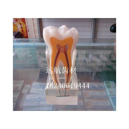 Dental model Crystal teeth Monomer profile model Dental materials free shipping