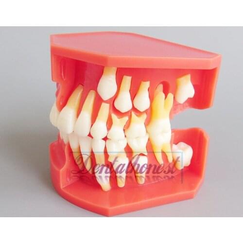 NEW Children Permanent Tooth Alternative Model Deciduous Teeth Removable Demonstration For Kids Teaching Studying