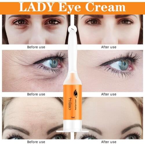 Hot sale LADY Eye Cream Instant Remove Eyebags Firming Eye Anti Puffiness Dark Circles Under Eye Anti Wrinkle Anti Age Eye Care