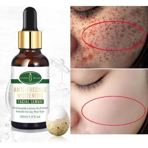 30ml Anti-Freckle Whitening Facial Serum Remove Melanin Pigment Dark Spots Face Essence Deep Moisturizing Tightening Skin Care