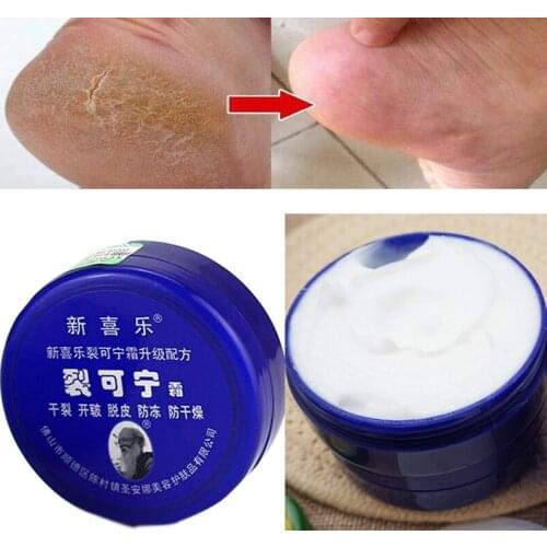 33g Cracked Heel Repair Cream To Remove Dead Skin Chinese Medicine Oil Control Anti-chapped Foot Cream Hand And Foot Care