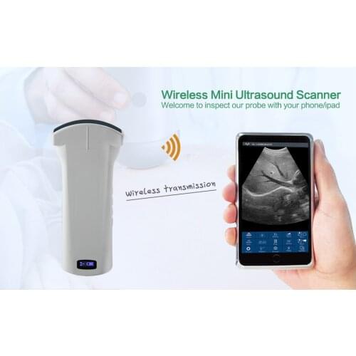 Advantage product Convex Series Probe Type Wireless Mini Ultrasound Scanner