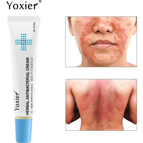 Yoxier Herbal Antibacterial Cream Psoriasis Cream Anti-itch Relief Eczema Skin Rash Urticaria Desquamation Treatment