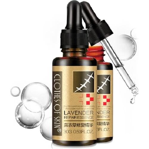 30ml Lavender Repair Essence Serum Oil Extract Against Black Dots Cream Scar Removal Facial Acne Skin Care Treatment Bleaching