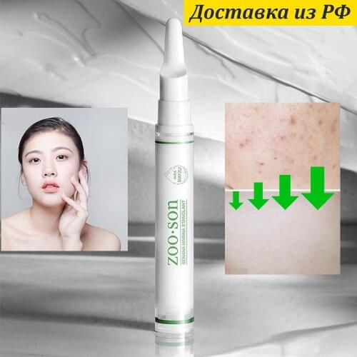 Zoo·Son Skin Care Products