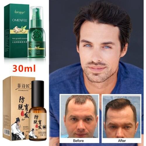 30ml Ginger Hair Growth Essence Spray Hair loss Treatment Preventing Hair Loss spray hair Growth Essence Hair Care for women