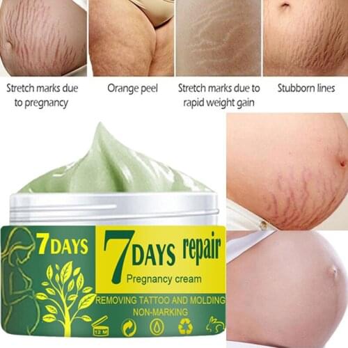 Pregnancy Repair Cream Firming Cream To Remove Pregnant Women Scars Acne Treatment Maternity Anti Aging Whitening Body Cream