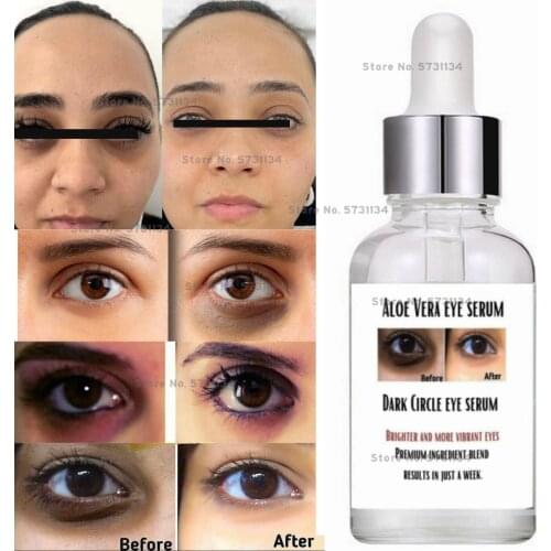 Dark Circles Remover, Under Eye Lightening Serum