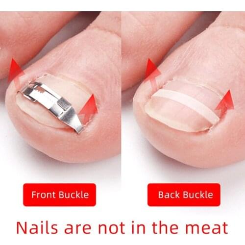 Q1QD Toenail Straightener Strip for Men Women Foot Care Ingrown Toenail Correction Sticker Adhesive Toenail Patch Elastic