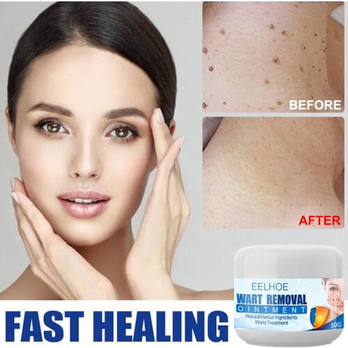 Wart Remover Safe Painless Skin Tags Removal Ointment Fast Acting Remover Cream for Warts Moles Corn for All Skins