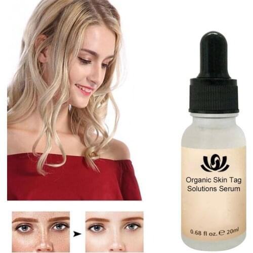 20ml Remover Serum Spotless Serum Remover Painless Mole Skin Stain Removal Face Wart Label Freckle Skin Removal Cream