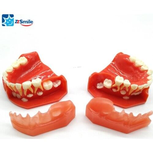Dental Pediatric Model age 5-9 M7012 Dental Teeth Model