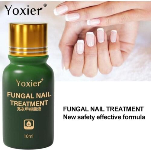 Yoxier Nail Fungal Treatment Feet Care Essence Nail Foot Whitening Toe Nail Fungus Removal Gel Anti Infection Paronychia TSLM1