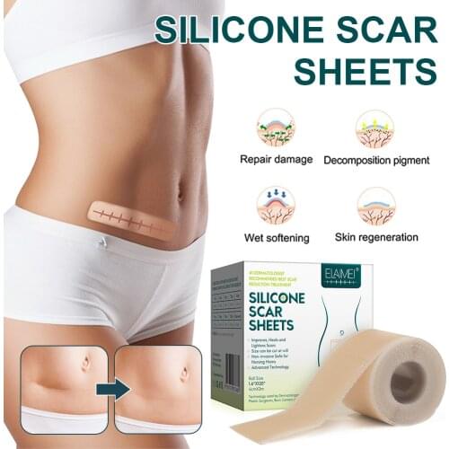 Efficient Beauty Scar Removal Silicone Gel Self-Adhesive Silicone Gel Tape Patch for Acne Burn Scar Reduce Burn Scar Skin Repair