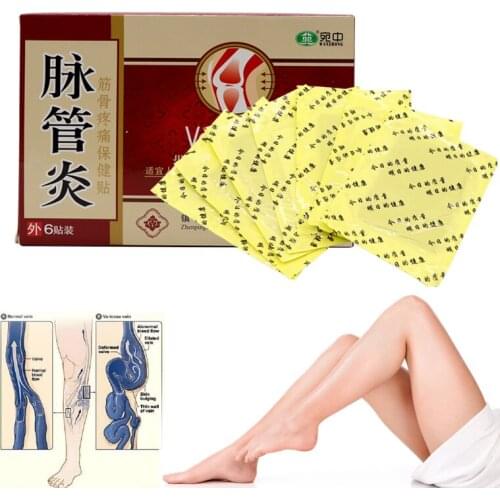 24pcs Varicose Veins Sticker Chinese Herbal Medicine Plaster Treatment Spider Varicosity Angiitis Removal Phlebitis Legs Veins