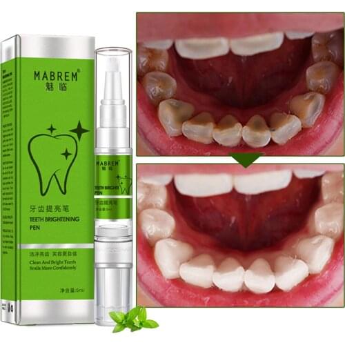 Teeth Brightening Pen Whitening Gel Cleaning Serum Oral Hygiene Care Essence Remove Stains Dental Bleaching Teeth Whitener 5ml