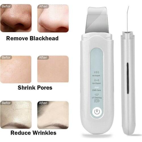 Ultrasonic Skin Scrubber Face Cleaning Skin Care Scrubber Facial Cleaner Shovel Spatula Peeling Blackhead Remover Lift Massager