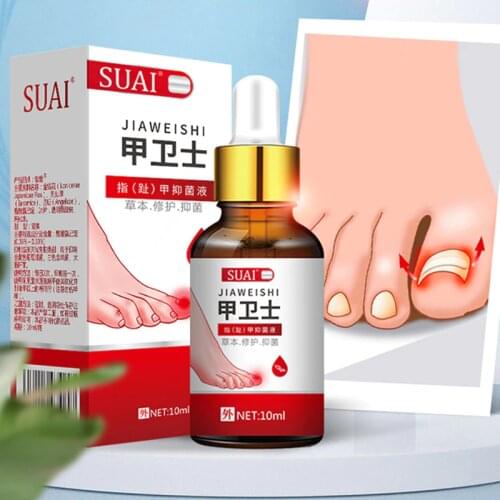 10ml Liquid Anti Nail Toenail Fungus Nail Treatments Pen Feet Care Nail Fungal Treatments Feet Care Essences Serum Fungus Remedy