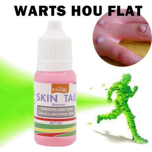Skin Tag Cure Removal Body Mole Wart Remover Spot Marks Wart Remover create Health Smooth and clean skin Body Care products new