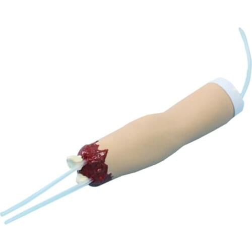 BIX-H2008 Upper Limb Amputated Trauma Hemostasis Medical Model