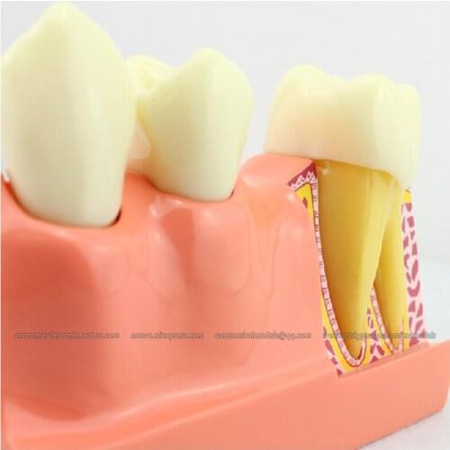 CMAM/12599 Dental- Tooth anatomy, Human Oral Dental Medical Teaching Anatomical Model